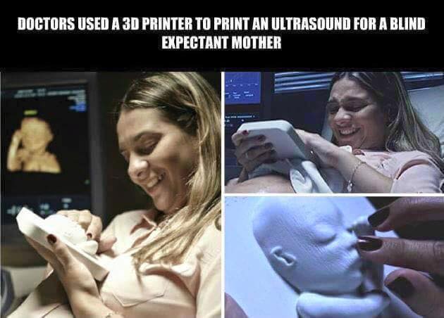 doctors_used_a_3d_printer_to_print_an_ultrasound_for_a_blind_expectant_mother